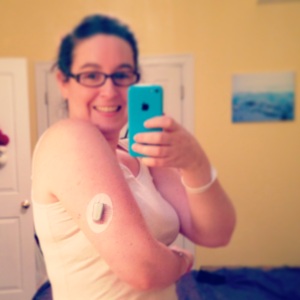 Dexcom sits on scar tissue all the time. 